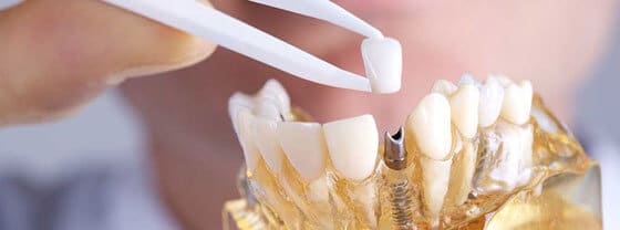 Sparks NV cosmetic dentist Dr. Sykes & Dr. Adams offers cosmetic dental services to patients in the Reno area