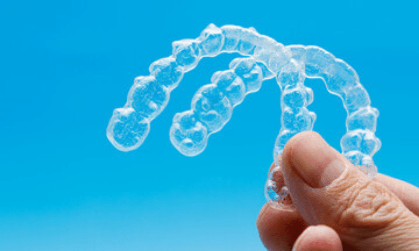 10 Commonly Asked Questions About Invisalign