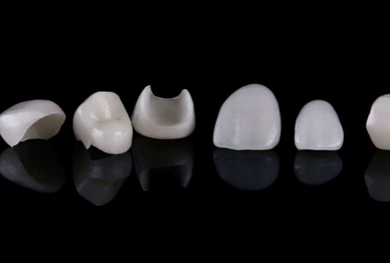 How to Take Care of Your Porcelain Veneers: Tips and Tricks