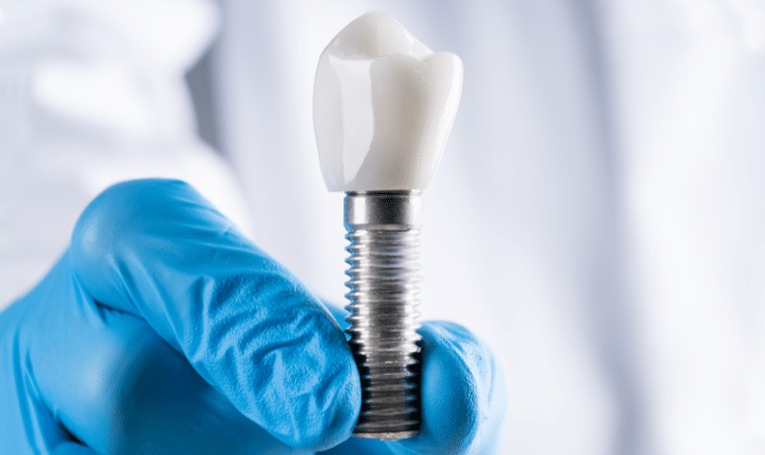 Unlocking the Benefits of Dental Implants: A Gateway to a Healthier Smile