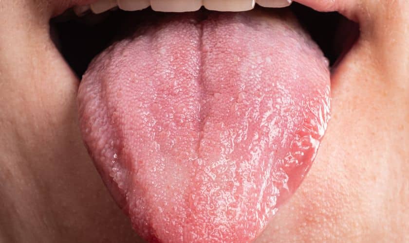Oral Cancer Warning Signs: What You Need to Know This Month