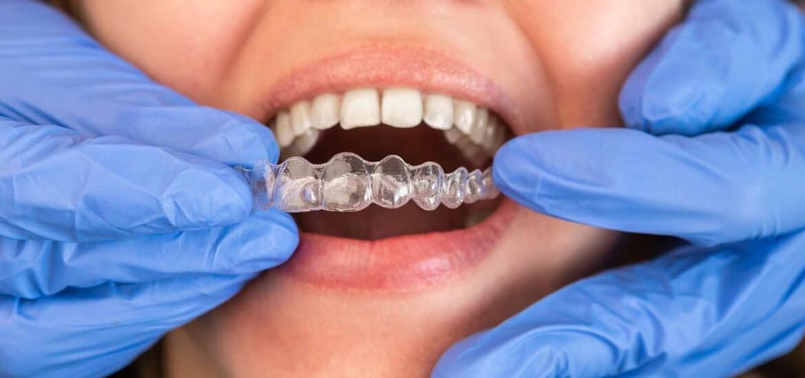 Invisalign Reno