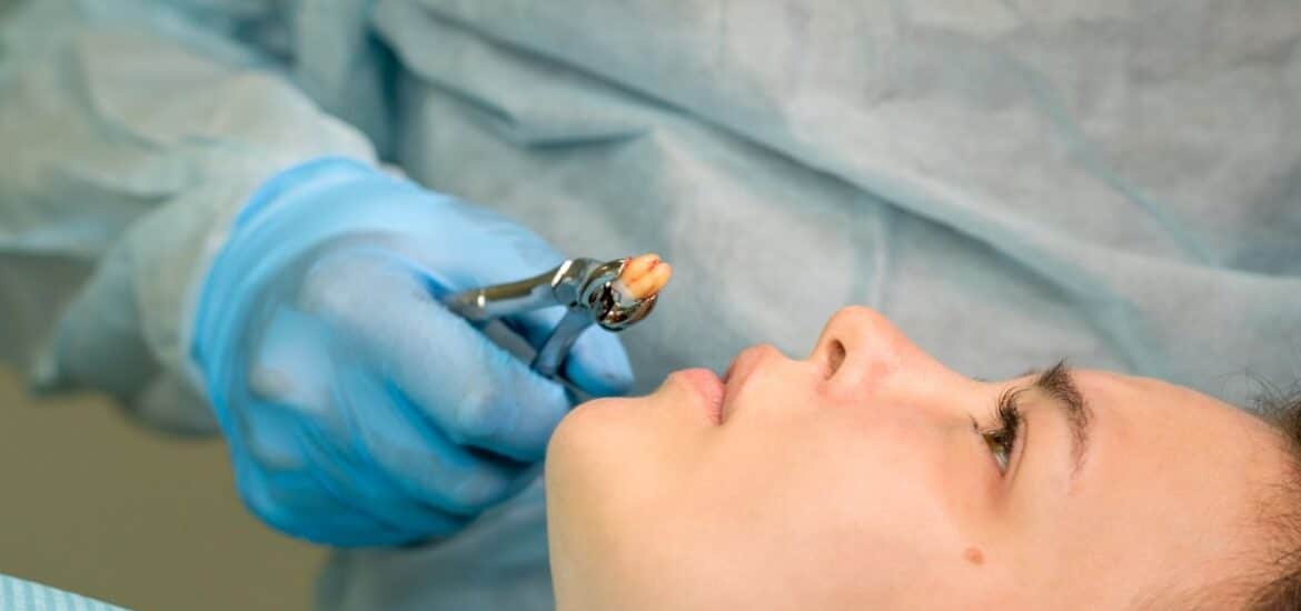 Tooth Extraction Reno