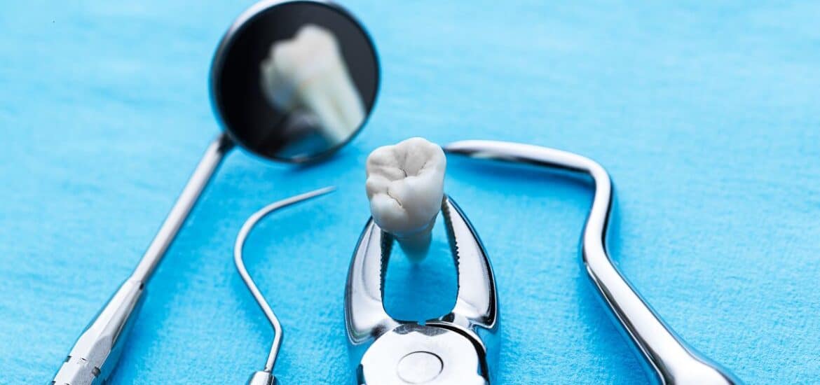 Tooth Extraction Reno