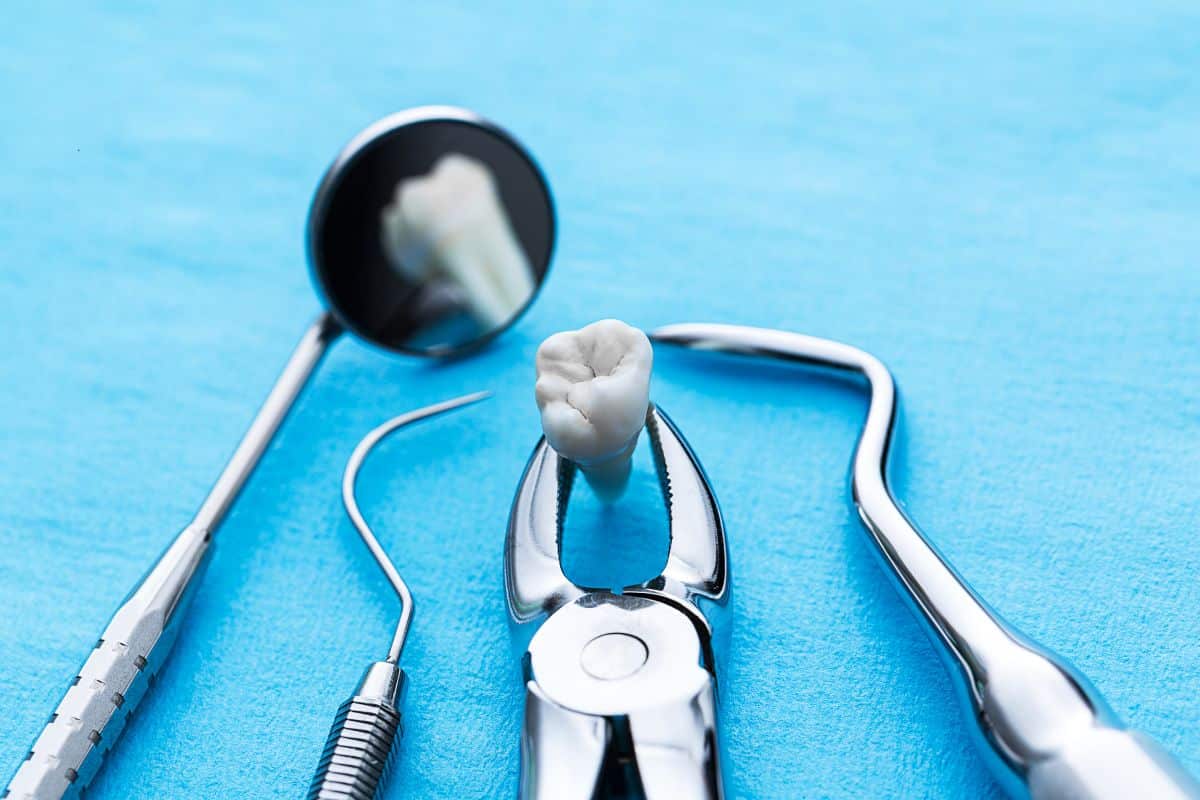 Understanding Tooth Extraction: What Reno Residents Need to Know