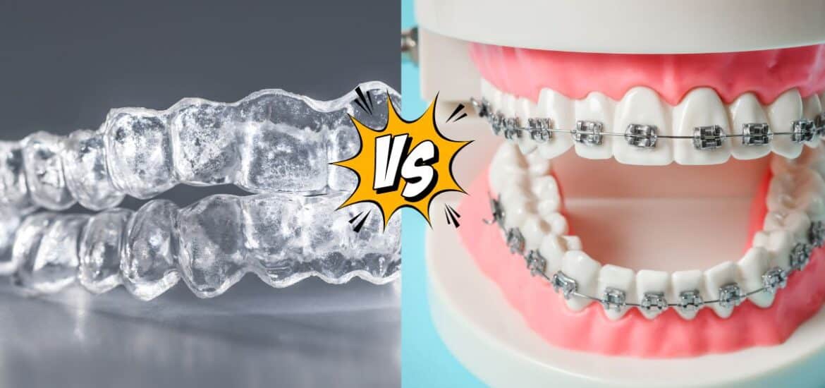 Invisalign Reno