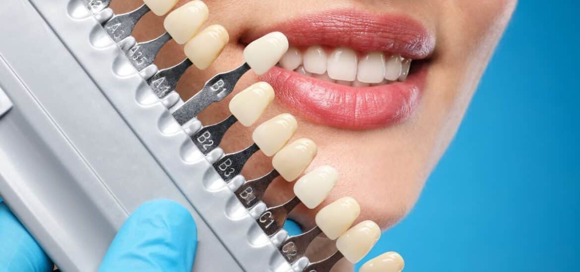 Cosmetic Dentist Reno