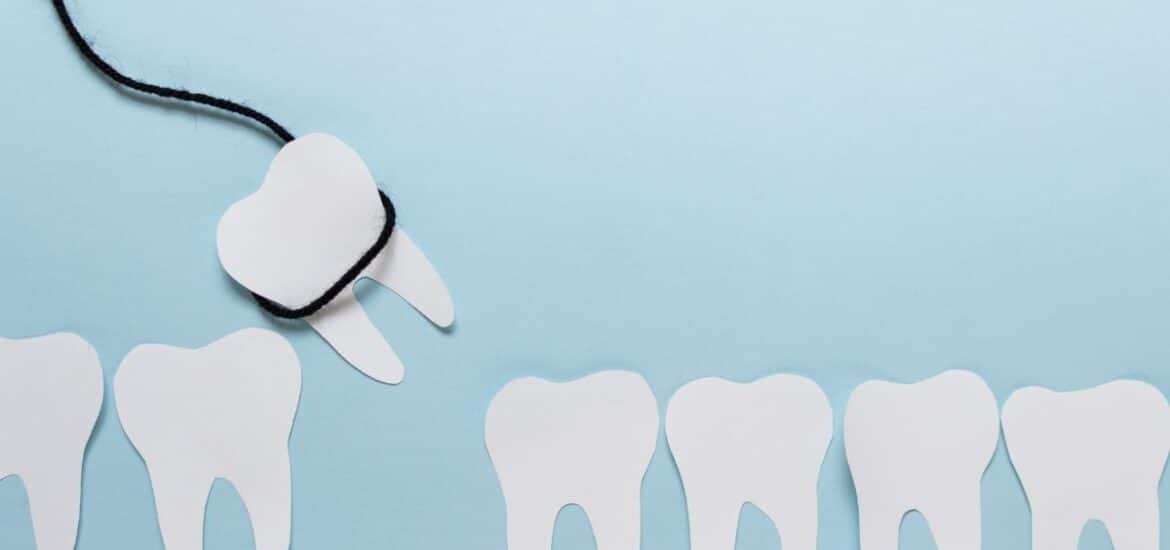 Tooth Extraction in Reno