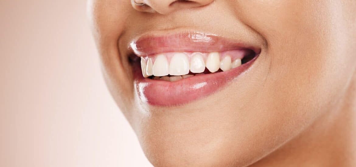 Close-up of a woman with a gummy smile.