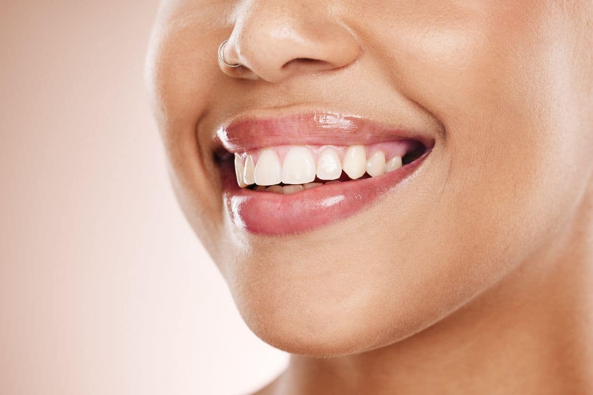 Fix a Gummy Smile: Six Proven Ways to Get a Confident Grin